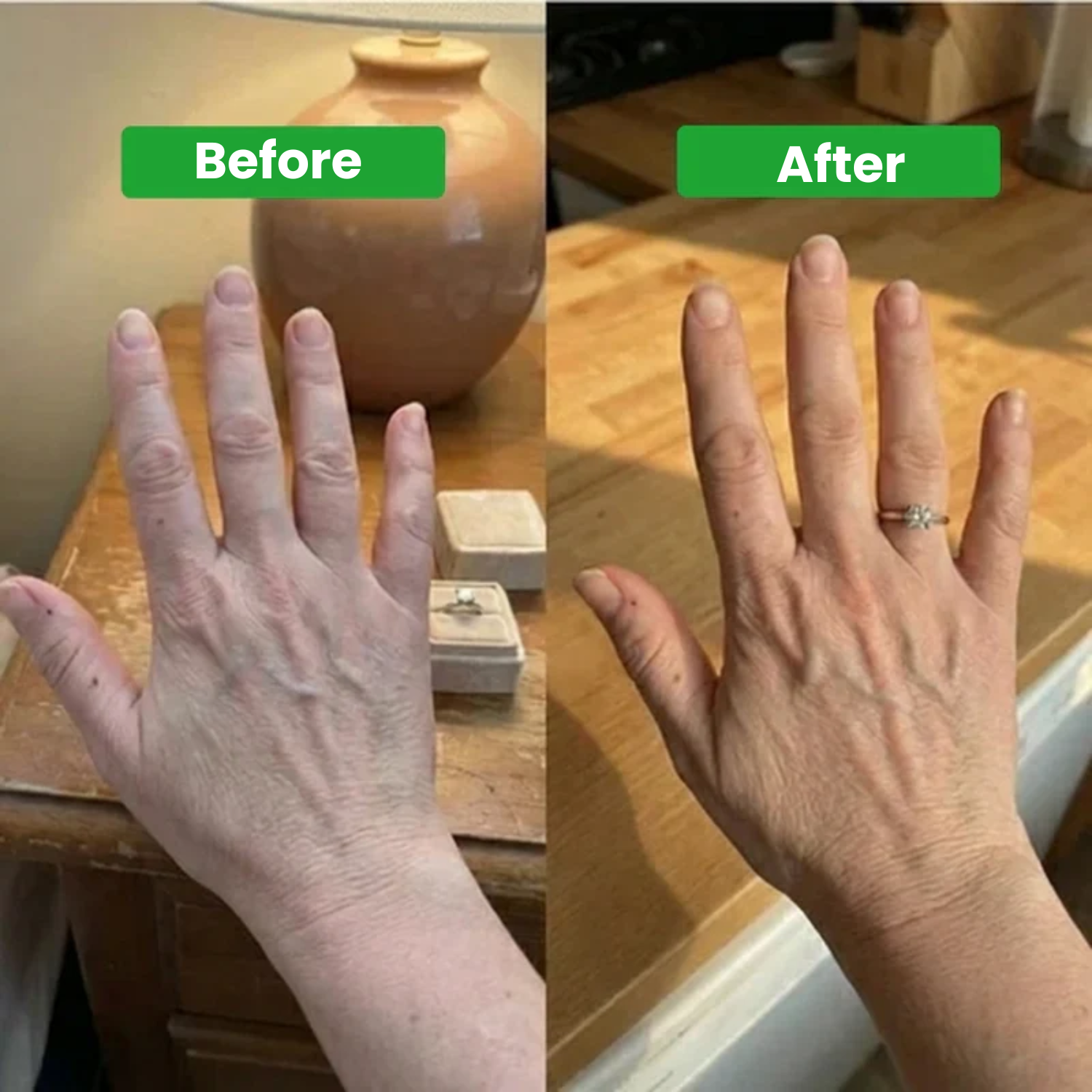 Lymphatic Drainage Drops