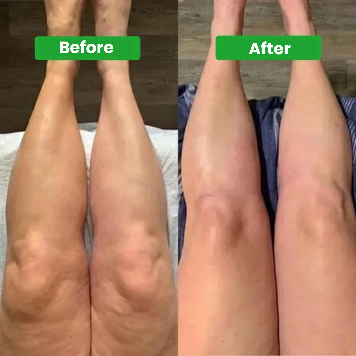 Lymphatic Drainage Drops